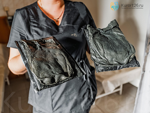 Санаторий «им. С.М. Кирова» Железноводск. Грязелечение